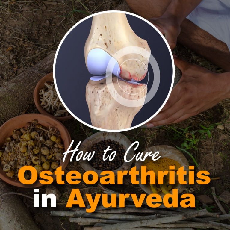 Osteoarthritis Cure in Ayurveda