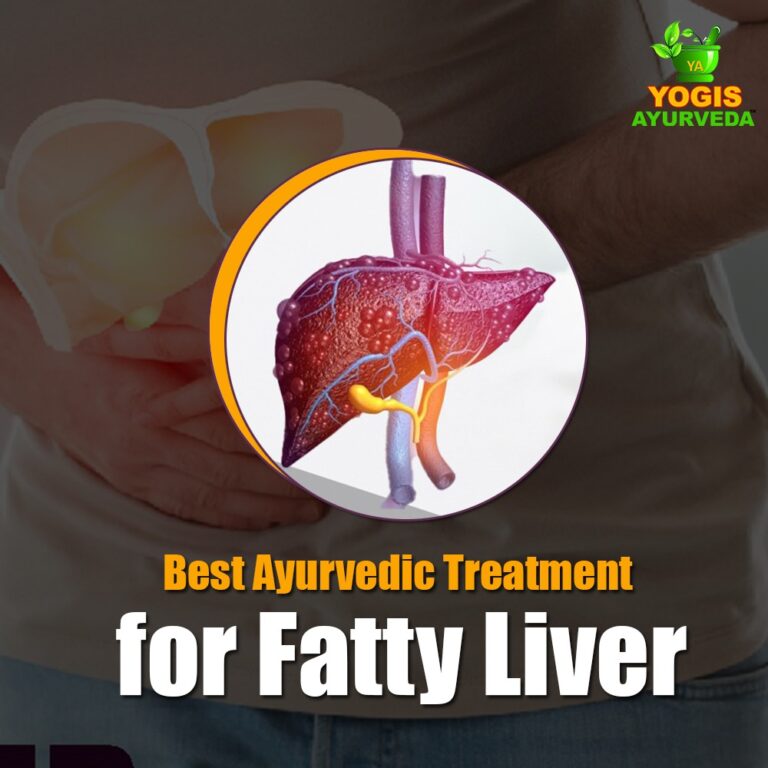 Best Ayurvedic Treatment for Fatty Liver