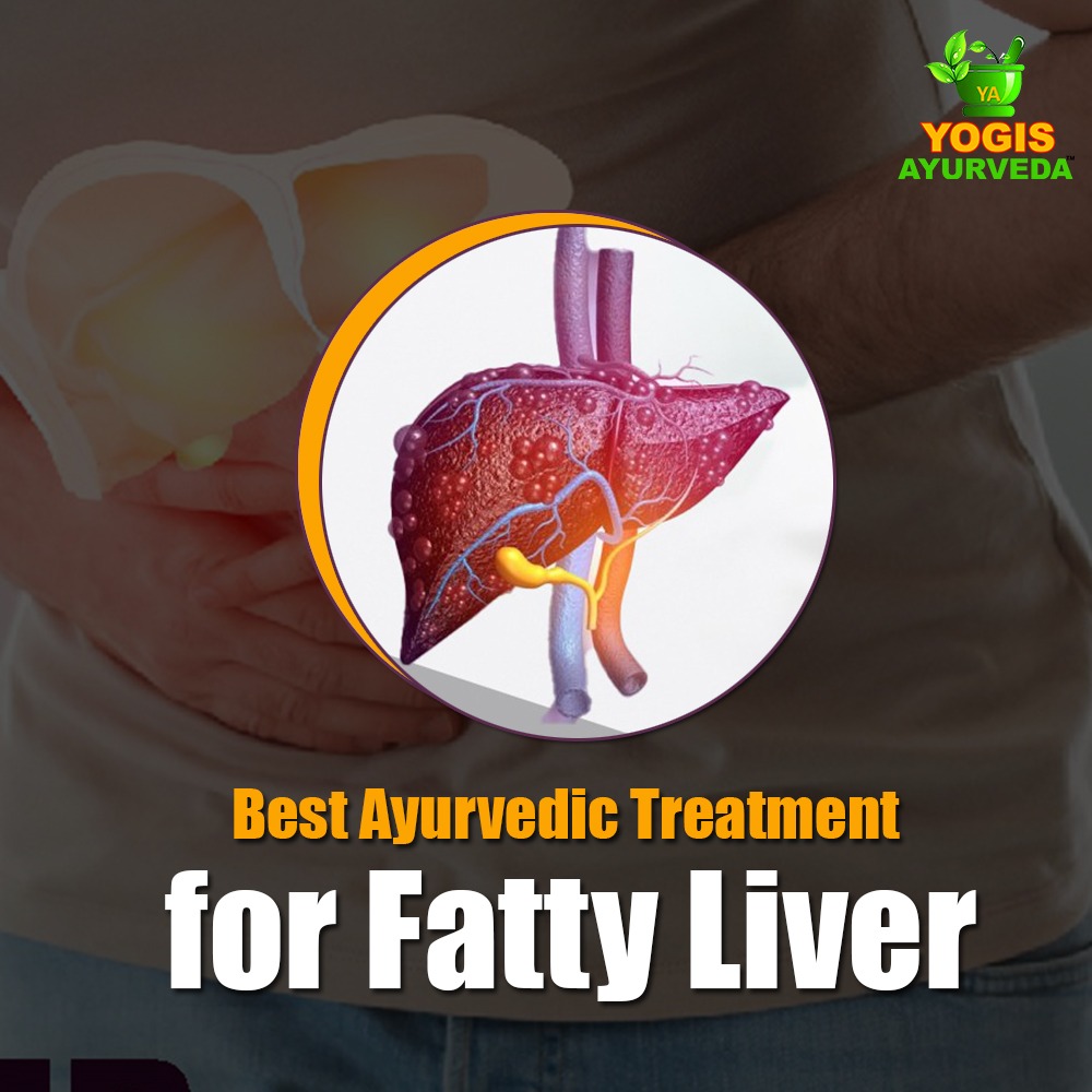 Ayuredic treatment for Fatty Liver
