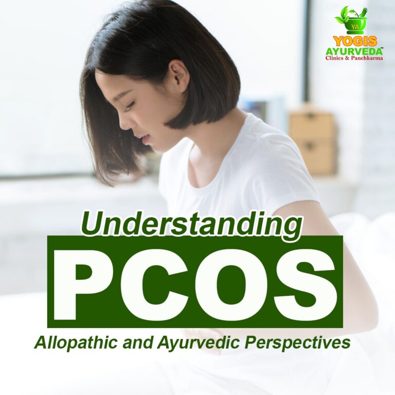 Understanding PCOS: Allopathic and Ayurvedic Perspectives