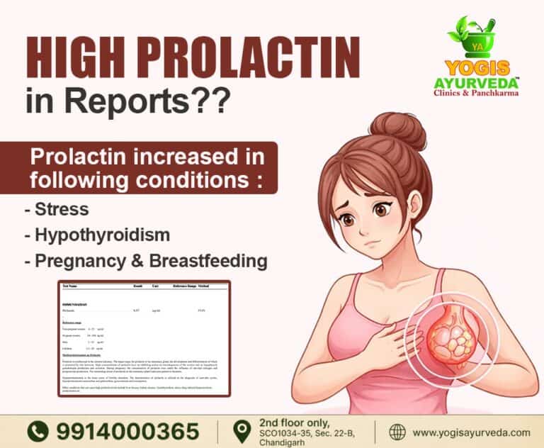 High Prolactin in Reports? इसके पीछे क्या Reasons हो सकते हैं?