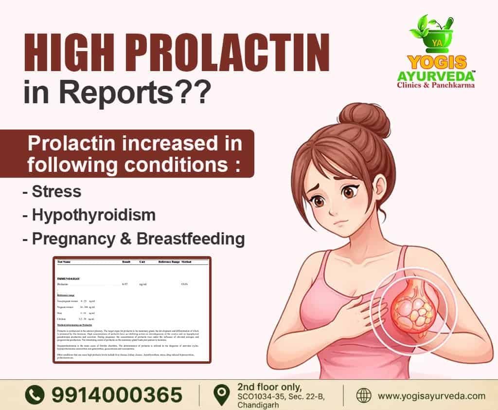 high-prolactin-in-reports-इसके-पीछे-क्या-reasons-हो-सकत